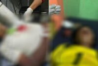 Dua Warga Gowa terkena busur, satu meninggal dunia dan satunya lagi kritis