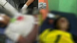 Dua Warga Gowa terkena busur, satu meninggal dunia dan satunya lagi kritis