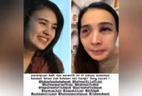 Putri Balqis dianiaya dan disiram bon cabe oleh suaminya berujung dipenjara