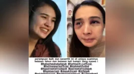Putri Balqis dianiaya dan disiram bon cabe oleh suaminya berujung dipenjara