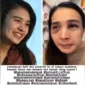 Putri Balqis dianiaya dan disiram bon cabe oleh suaminya berujung dipenjara