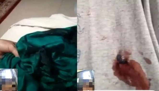 Foto Kolase : Habib Bahar ditembak, sampai Kaos Berlubang, (Youtube Mahesa Al Bantani)