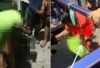 Insiden Kebakaran di Maccini Tengah, Bokong Remaja Tertusuk Balok Kayu Bukan Besi Plat