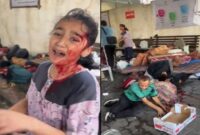 Korban RS Al Shifa Gaza