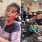Korban RS Al Shifa Gaza