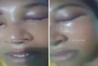 Korban KDRT di Riau, Suami Injak Mata istri (Foto Kolase)