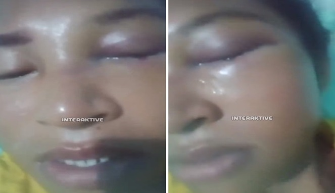 Korban KDRT di Riau, Suami Injak Mata istri (Foto Kolase)