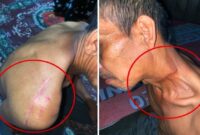 Suami Suminah Jadi Korban Tebasan Senjata Tajam hingga Alami Cacat Seumur Hidup