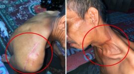 Suami Suminah Jadi Korban Tebasan Senjata Tajam hingga Alami Cacat Seumur Hidup