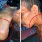 Suami Suminah Jadi Korban Tebasan Senjata Tajam hingga Alami Cacat Seumur Hidup