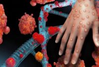 Wabah Cacar Monyet atau mpox di Afrika tahun ini meningkat tajam hingga di atas 500 persen (Foto Ilustrasi/Ist)