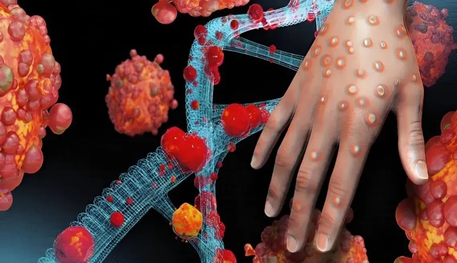 Wabah Cacar Monyet atau mpox di Afrika tahun ini meningkat tajam hingga di atas 500 persen (Foto Ilustrasi/Ist)