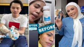 Foto Kolase : dr Oky Pratam, Testimoni Produk Zam-zam Whitening Cream dan Owner Zam-zam Nur Apriliana