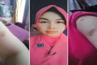 Foto Kolase : Ernawati, Istri Seorang Polisi Dianiaya oleh Pemilik Klinik Dr. Cece