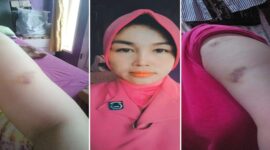 Foto Kolase : Ernawati, Istri Seorang Polisi Dianiaya oleh Pemilik Klinik Dr. Cece