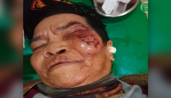 Pelaku Tahari, Ayah yang Memperkosa Anak Kandung Tuna Wicara di Gowa Babak Belur Usai Dihajar Warga