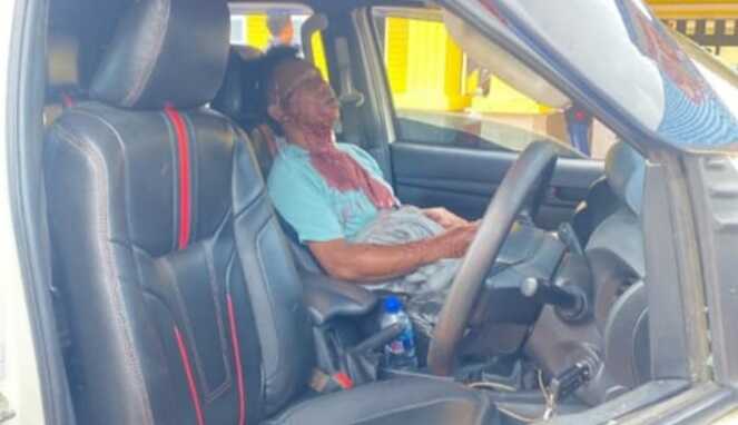 Sopir asal Jeneponto mengalami luka parah akibat pembacokan oleh Orang Tak Dikenal (OTK) di Papua Tengah.