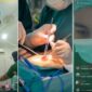 Tangkapan layar video perawat live saat operasi caesar