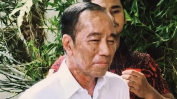 Jepretan foto salah satu awak media, terlihat wajah Jokowi dipenuhi bercak putih di pipi, dahi, hingga leher tampak memerah.