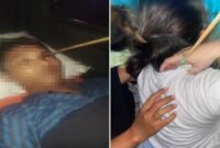 Foto Kolase – Seorang pemuda di Tallo tertembus busur panah di mata, sementara seorang perempuan muda juga menjadi korban busur panah di leher belakang.