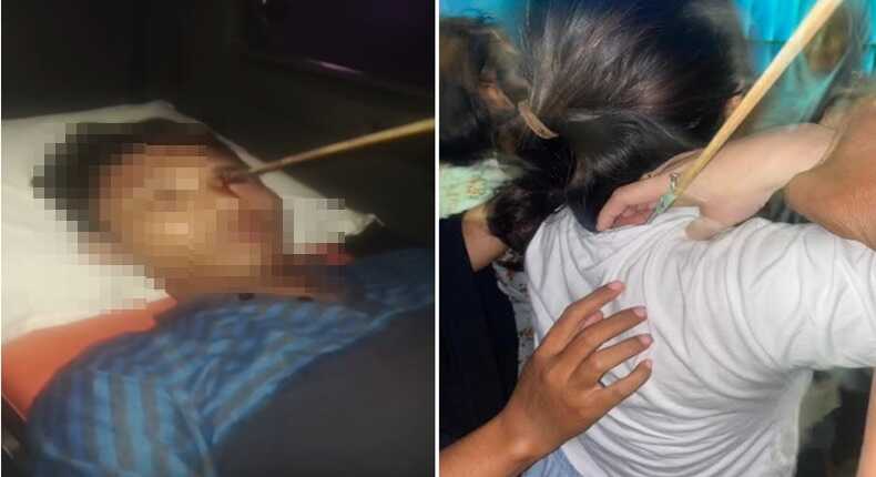 Foto Kolase – Seorang pemuda di Tallo tertembus busur panah di mata, sementara seorang perempuan muda juga menjadi korban busur panah di leher belakang.