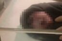 Tangkapan layar video viral yang memperlihatkan kondisi bayi bermata satu saat dilahirkan di RSUD Kota Kendari, Sulawesi Tenggara.