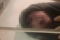 Tangkapan layar video viral yang memperlihatkan kondisi bayi bermata satu saat dilahirkan di RSUD Kota Kendari, Sulawesi Tenggara.