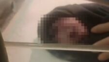 Tangkapan layar video viral yang memperlihatkan kondisi bayi bermata satu saat dilahirkan di RSUD Kota Kendari, Sulawesi Tenggara.