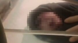 Tangkapan layar video viral yang memperlihatkan kondisi bayi bermata satu saat dilahirkan di RSUD Kota Kendari, Sulawesi Tenggara.