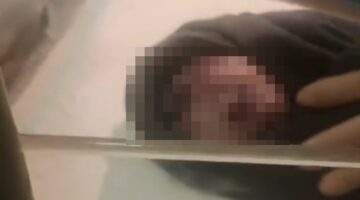 Tangkapan layar video viral yang memperlihatkan kondisi bayi bermata satu saat dilahirkan di RSUD Kota Kendari, Sulawesi Tenggara.