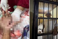 Foto close-up penanganan medis pada luka tebas serius di telapak tangan kiri Hz. Di sebelah kanan, foto menunjukkan Hz, seorang tokoh masyarakat dengan kemeja dan peci putih, berdiri di dalam sel tahanan Polsek. (Kolase)