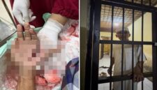 Foto close-up penanganan medis pada luka tebas serius di telapak tangan kiri Hz. Di sebelah kanan, foto menunjukkan Hz, seorang tokoh masyarakat dengan kemeja dan peci putih, berdiri di dalam sel tahanan Polsek. (Kolase)