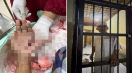 Foto close-up penanganan medis pada luka tebas serius di telapak tangan kiri Hz. Di sebelah kanan, foto menunjukkan Hz, seorang tokoh masyarakat dengan kemeja dan peci putih, berdiri di dalam sel tahanan Polsek. (Kolase)