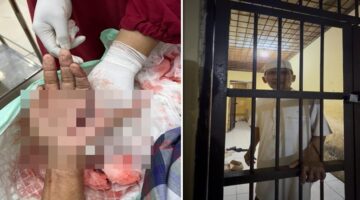 Foto close-up penanganan medis pada luka tebas serius di telapak tangan kiri Hz. Di sebelah kanan, foto menunjukkan Hz, seorang tokoh masyarakat dengan kemeja dan peci putih, berdiri di dalam sel tahanan Polsek. (Kolase)