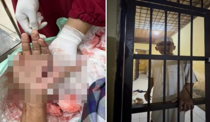 Pilu Tokoh Masyarakat Jeneponto, Tangan Nyaris Putus Tegur Prostitusi Malah Dibui