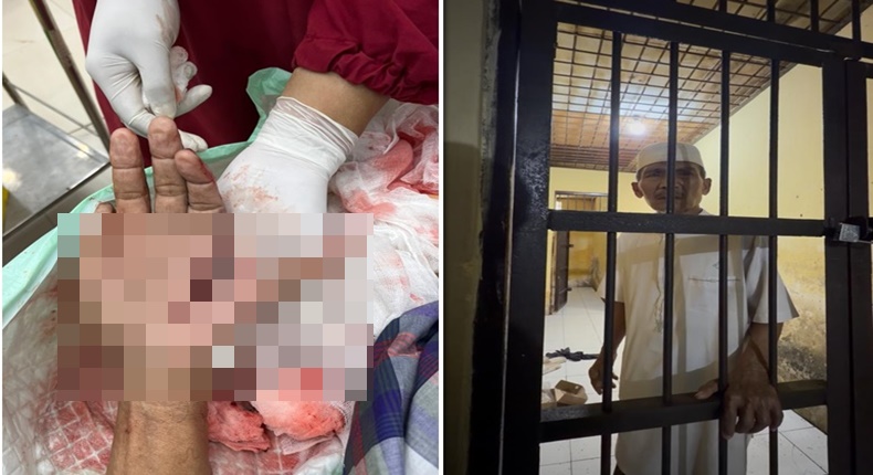 Foto close-up penanganan medis pada luka tebas serius di telapak tangan kiri Hz. Di sebelah kanan, foto menunjukkan Hz, seorang tokoh masyarakat dengan kemeja dan peci putih, berdiri di dalam sel tahanan Polsek. (Kolase)