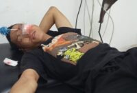 Korban penyerangan, Supriyadi, menerima perawatan medis usai dibusur di bagian pelipis mata sebelah kiri akibat serangan sekelompok geng motor di kawasan Panakkukang, Makassar, Senin (17/8/2026).