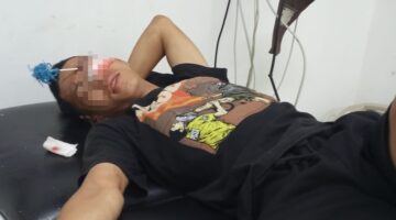 Korban penyerangan, Supriyadi, menerima perawatan medis usai dibusur di bagian pelipis mata sebelah kiri akibat serangan sekelompok geng motor di kawasan Panakkukang, Makassar, Senin (17/8/2026).