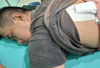 Kondisi Rahmat Saputra (36), pedagang korban pembacokan di Percut Sei Tuan, saat menjalani perawatan medis dengan perban penutup luka jahitan di punggungnya.