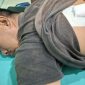 Kondisi Rahmat Saputra (36), pedagang korban pembacokan di Percut Sei Tuan, saat menjalani perawatan medis dengan perban penutup luka jahitan di punggungnya.